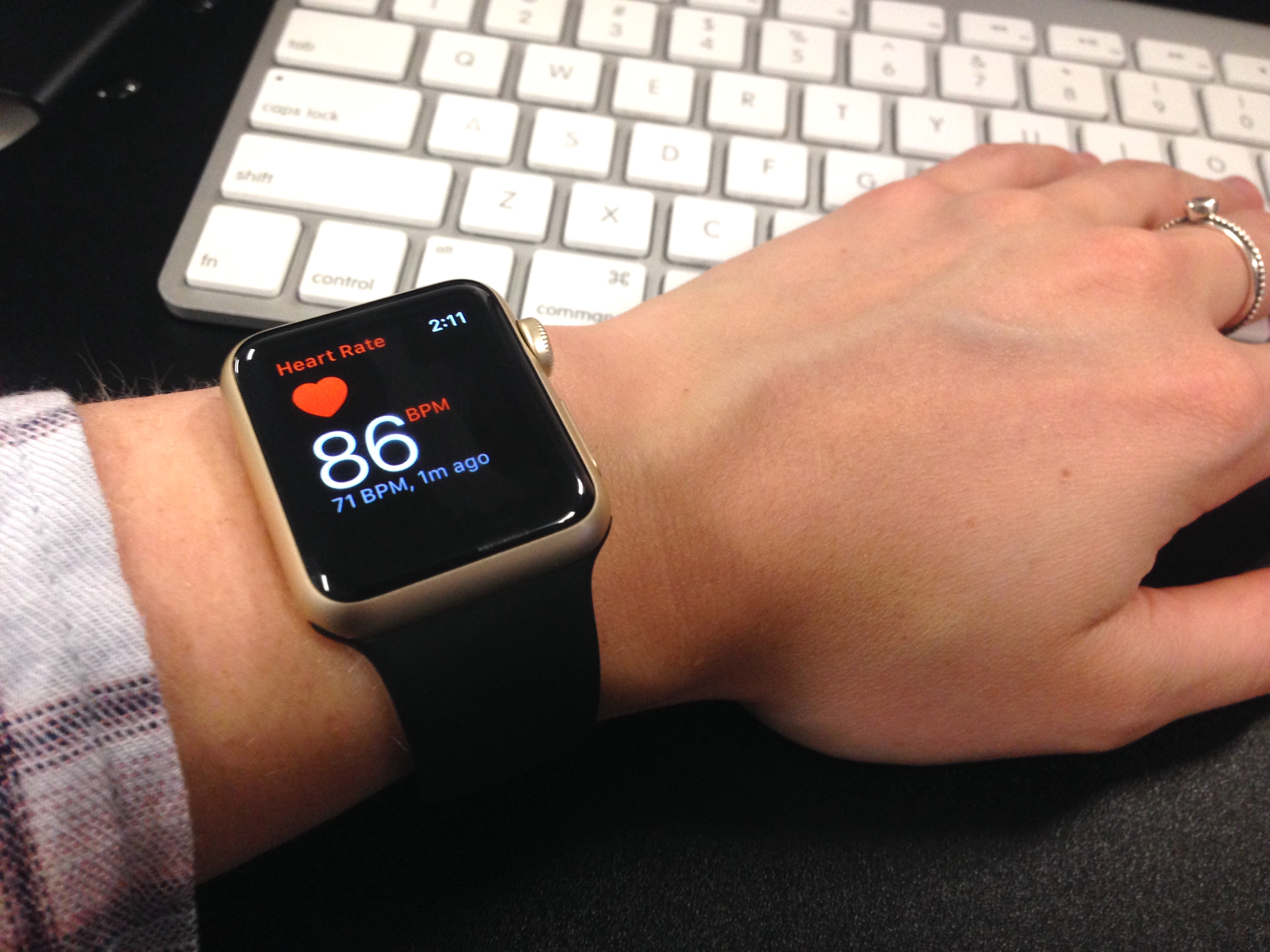 A Cardiologist's Take on Smartwatch ECG Monitors and Heart Health