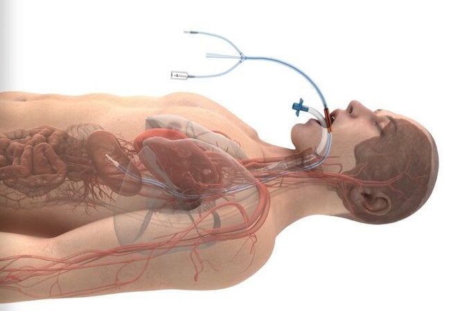 Hot & Cold Esophageal Temperature Monitoring System