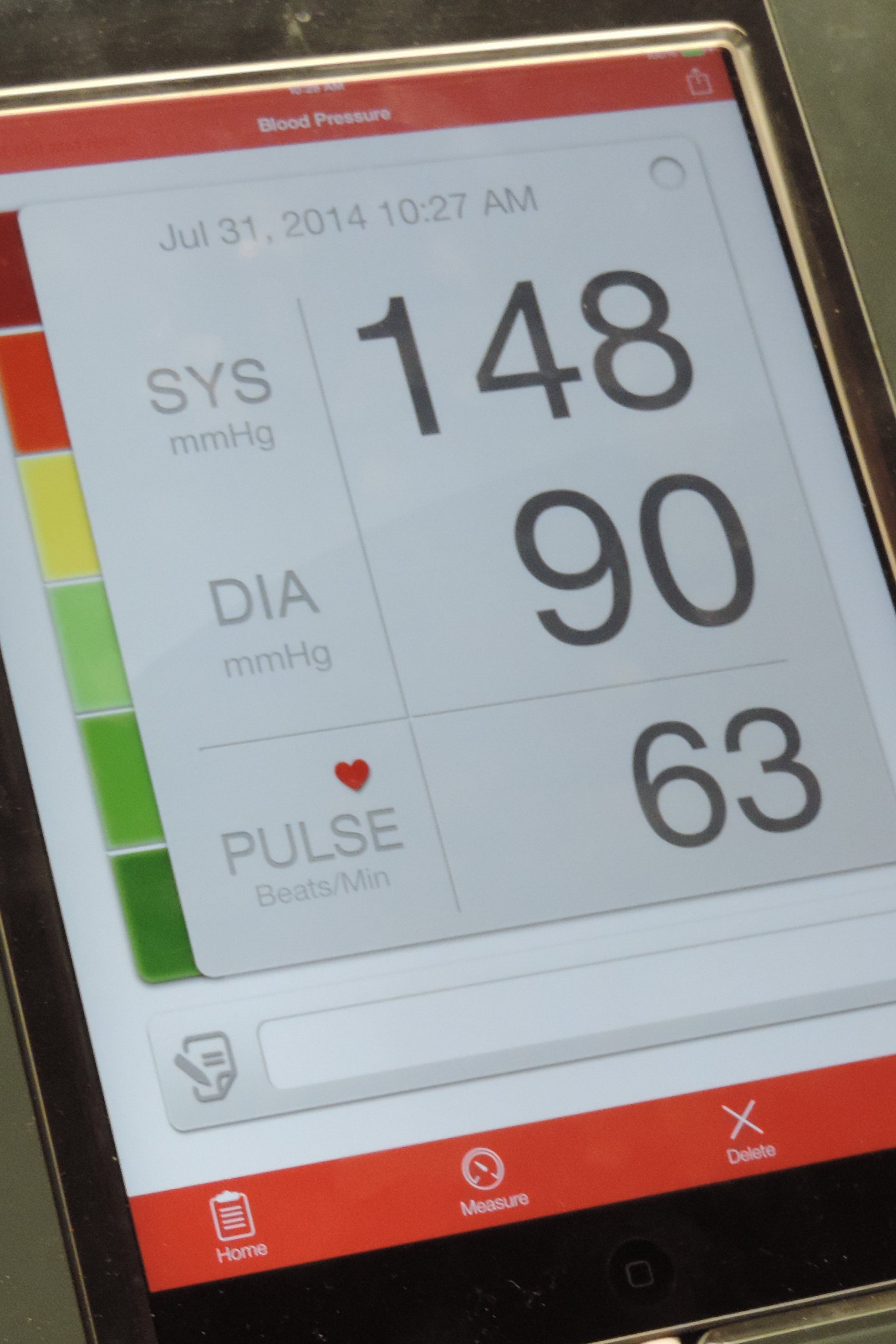 Apple Watch X with blood pressure monitor looks like a big winner - analyst