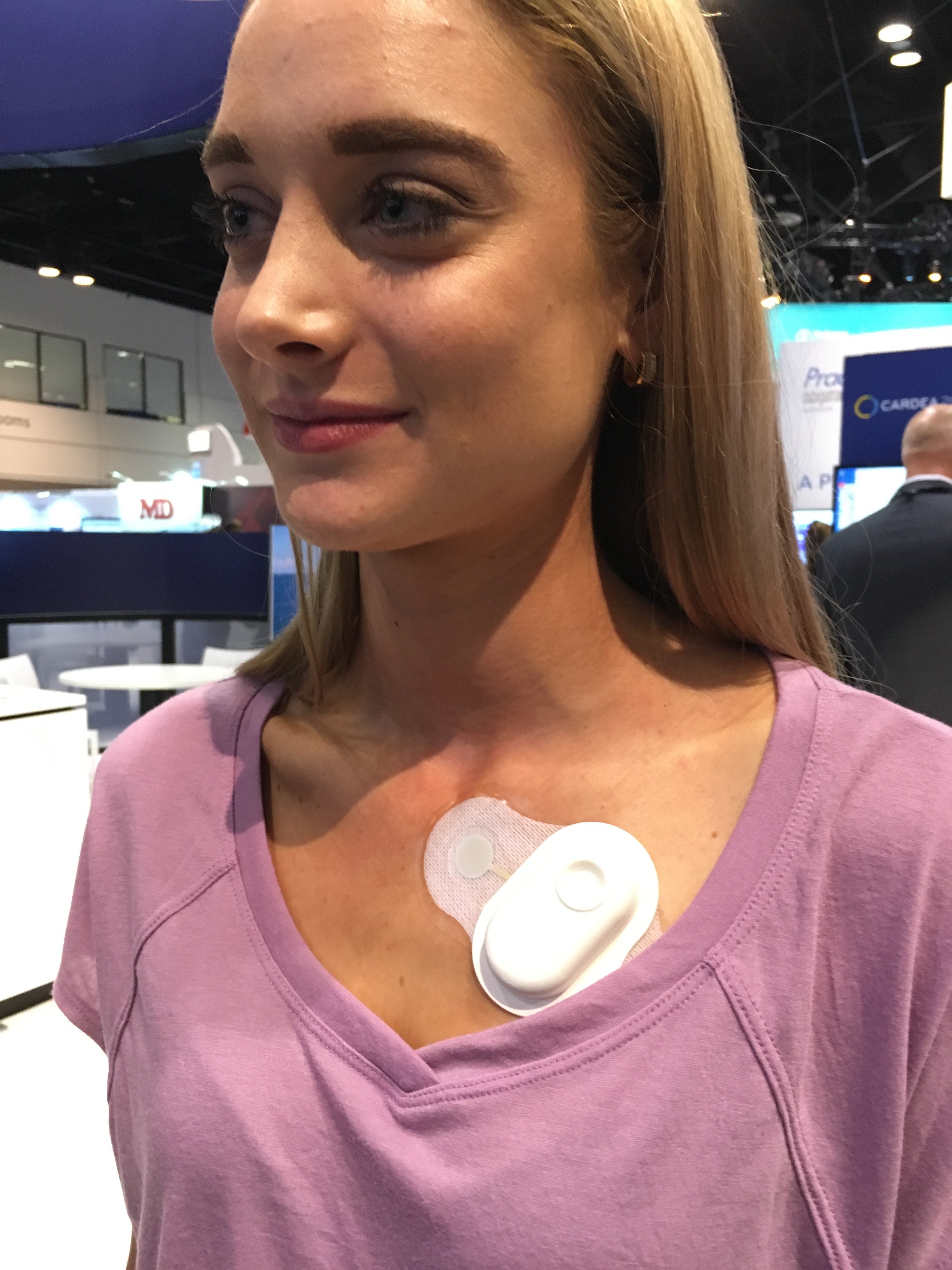 Belt with sensors monitors heart parameters 24/7 - Today's Medical