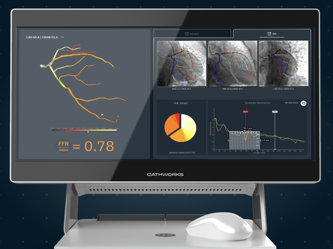 CathWorks が TCT 2022 の主要イベントを発表