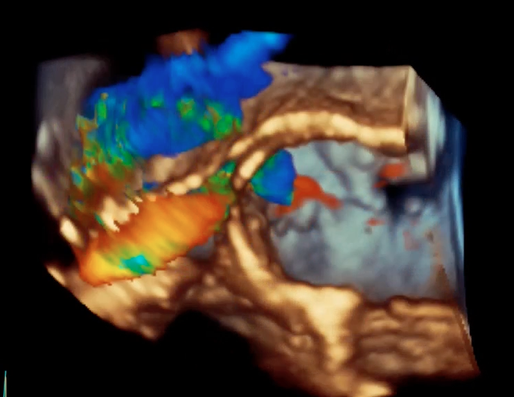 VIDEO: Can We Live in 3-D Echo?