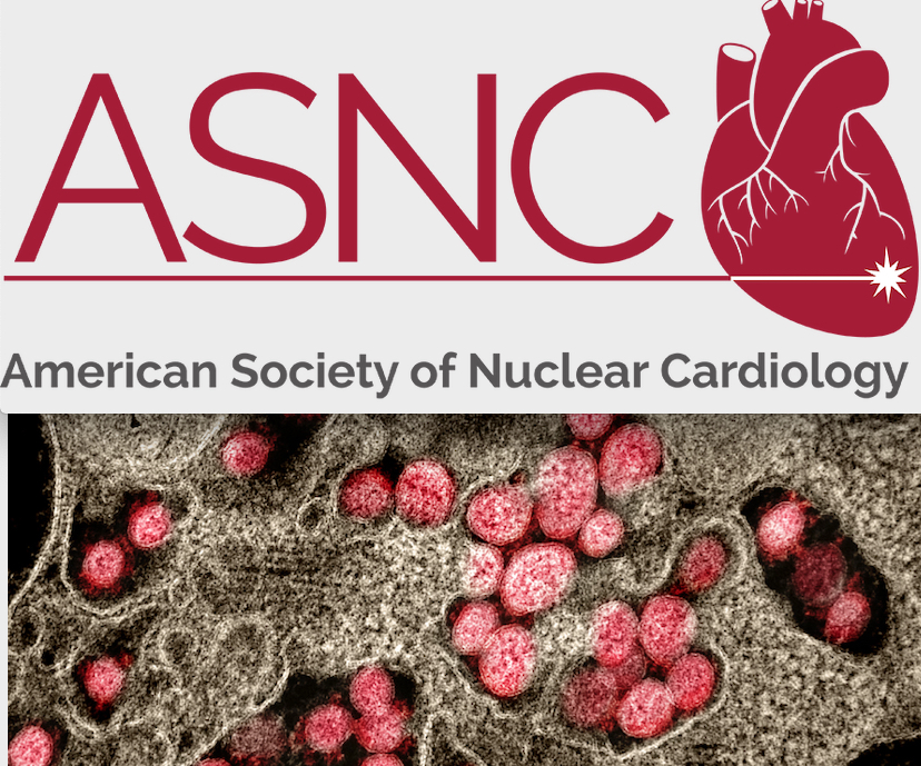 American Society of Nuclear Cardiology 2020 Meeting Goes Virtual Due to COVID-19 | DAIC