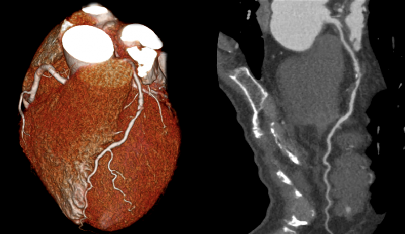 cardiac diagnostics testosterone jama