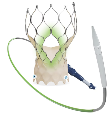 Late-breaking data included a SMART Trial secondary analysis showing significantly less bioprosthetic valve dysfunction with Evolut TAV across the entire range of small annulus areas when compared with the Edwards Sapien 3 TAV platform
