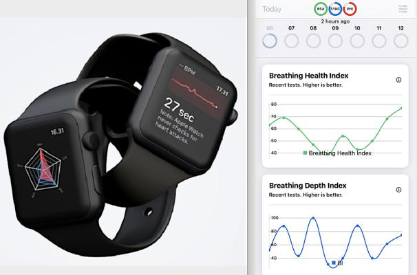 ECG smartwatches explained: How they work and the best on the market -  Wareable