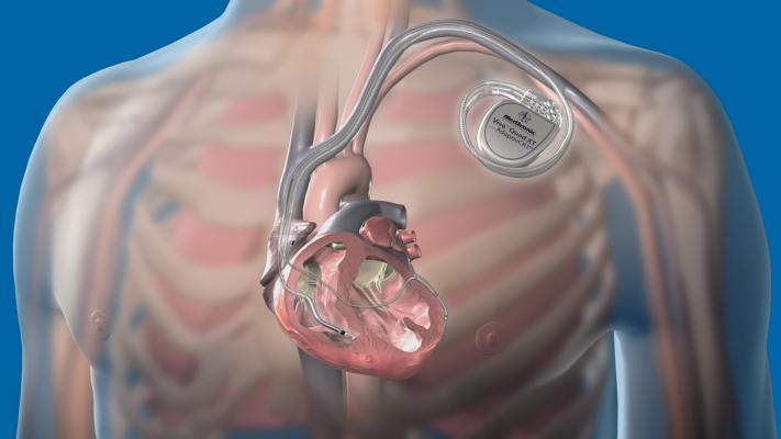 Heart Failure Medication Adherence Improves Following Crt Device Implant Daic