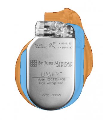 St Jude Medical Gains Ce Mark For Assura Implantable Defibrillators Including New Quadripolar Device Daic