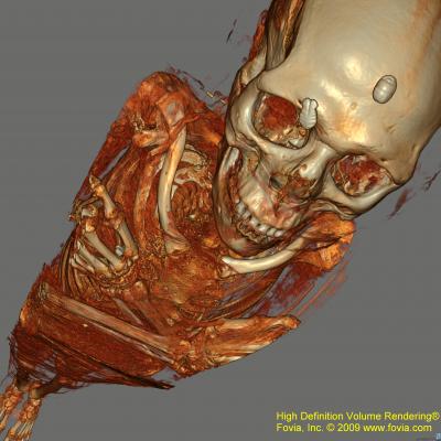 3-D reconstruction of an amulet wrapped inside a mummy as seen in a CT scan.