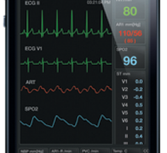 ECG wireless remote access software device