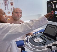 Royal Philips has announced its AI-enabled cardiovascular ultrasound platform to help speed up cardiac ultrasound analysis with proven AI technology, reporting that results of a new scientific abstract being presented at the American Society of Echocardiography (ASE 2024) annual meeting, June 14-16 in Portland, OR, will demonstrate how first-of-kind AI algorithms co-developed with Philips provide highly accurate detection of regional wall motion abnormalities (RWMA) on echocardiography.