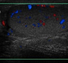 aging, mechanism that impairs blood flow, University of Missouri study, mesenteric arteries