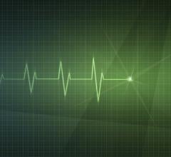 bradycardia, Wake Forest Baptist study, development of heart disease