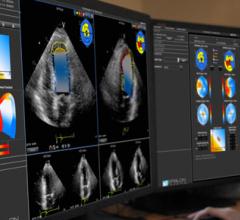 Choosing Wisely ASE Echocardiogram