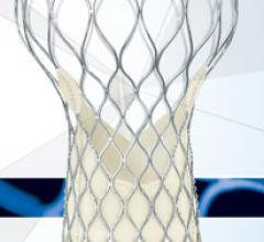 Clinical trial/Study, Heart Valve Repair, CoreValve System