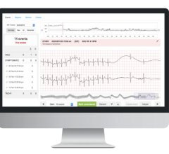 joint research collaboration agreement to develop and commercialize the next generation of remote cardiac care solutions