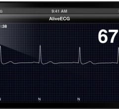 AliveCor Heart Monitor Phone Atrial Fibrillation 