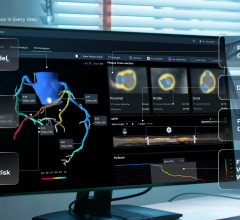 Heartflow PCI Navigator Heartflow Introduces PCI Planning Tool
