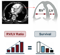 Penumbra STORM-PE Randomized Controlled Trial: CAVT with Anticoagulation Superior to Traditional Anticoagulation Treatment