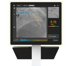 SpectraWAVE X1 SpectraWAVE Receives 510(k) Clearance for AI-enabled, Wire-Free, Drug-Free, Single Angiogram Physiology Solution