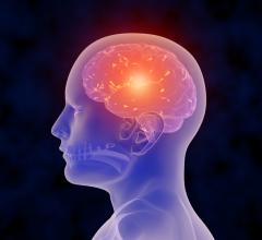 Basking Biosciences Stroke Basking Biosciences Phase 2 Stroke Trial Progresses; Company Names New CEO